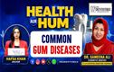 مسوڑھوں کی عام بیماریاں، ان کی علامات اور علاج 